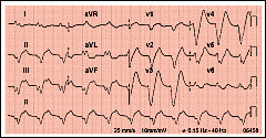 Pulse para ampliar el ECG