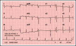 Pulse para ampliar el ECG